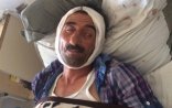 Maşın vuran piyadanın qanı batır – FOTO