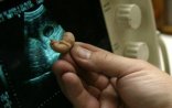 Məktəbli qızları aborta aparan -SƏBƏB