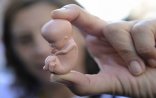 Azərbaycanda 308 məktəbyaşlı qadın abort etdirib - RƏSMİ