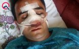 Bakıda “Bravo”nun rəhbər şəxsini döydülər-Döyülən şəxs jurnalistin bacısı oğludur