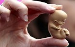 Azərbaycanda cütlüklər abortu “qoruyucu vasitə” hesab edir - SORĞU