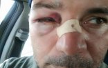 Döyülən jurnalistə rüşvət təklif olundu – “Müstəntiq bunu nəzərə almır”