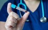Azərbaycanda daha 64 nəfərdə koronavirus aşkarlanıb, 11 nəfər sağalıb