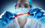 Koronavirusla müharibənin döyüşçülərindən biri: doktor Elşən Əliyev