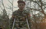 ŞOK QƏRAR: Bir ayağını itirmiş 19 yaşlı qaziyə III qrup əlillik verildi - FOTOLAR