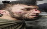 Moskvadakı terrorda şübhəli bilinənlər belə həbs edildi –Saxlanılan zaman çəkilən FOTOLAR