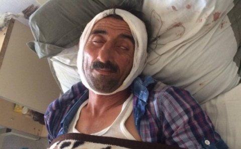 Maşın vuran piyadanın qanı batır – FOTO