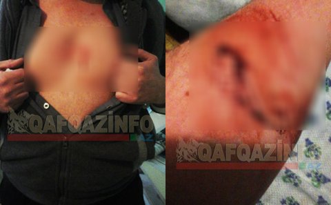 Ağsuda əlili ölümünə döydülər – FOTOLAR