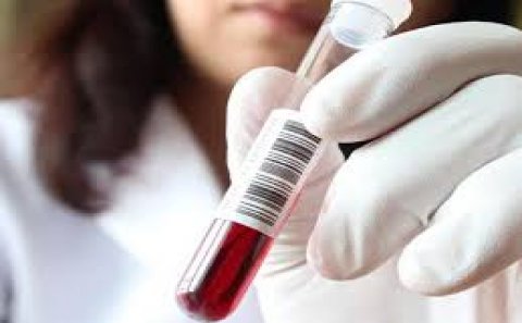 Azərbaycanda hansı virus aşkarlandı?-Səhiyyə Nazirliyi