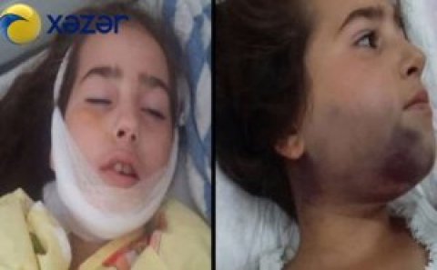 10 yaşlı uşağı 9-cu mərtəbədən atdılar-Bakıda 