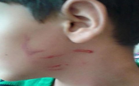 Bakıda müəllim şagirdin başını partaya çırpdı – FOTO
