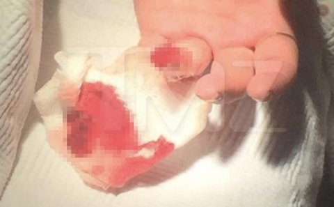 Yerdən tapdığı qələm partladı... barmaqları qopdu - AĞCABƏDİDƏ QORXUNC OLAY