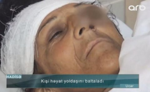 Oğlunun gözü qarşısında baltalanan qadının görüntüləri yayıldı – FOTO – VİDEO