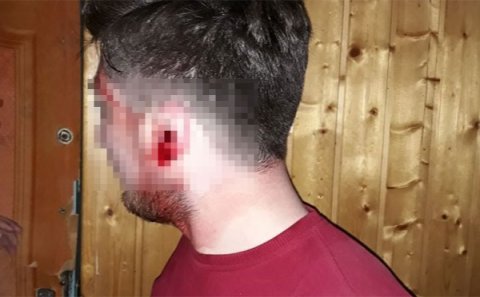 Yol polisləri sürücünü vəhşicəsinə döydü: 