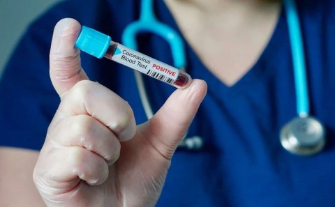 Azərbaycanda daha 64 nəfərdə koronavirus aşkarlanıb, 11 nəfər sağalıb