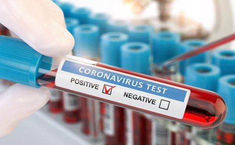 Azərbaycanda daha 113 nəfər koronavirusa yoluxdu, 55 nəfər sağaldı