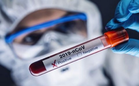 Azərbaycanda koronavirusa yoluxanların sayı yenidən artdı - Ölənlər var