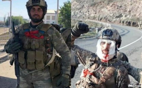 Hərbiçimiz başından yaralansa da, Şuşa döyüşlərində iştirak etdi - FOTO