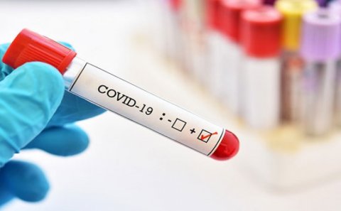 Azərbaycanda koronavirusa yoluxanların sayı rekord həddə çatdı - 34 nəfər öldü