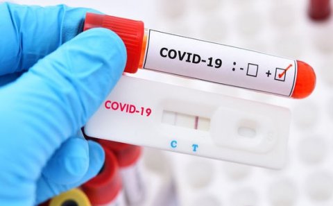 Azərbaycanda koronavirusa yoluxanların sayı artdı - 10 nəfər öldü