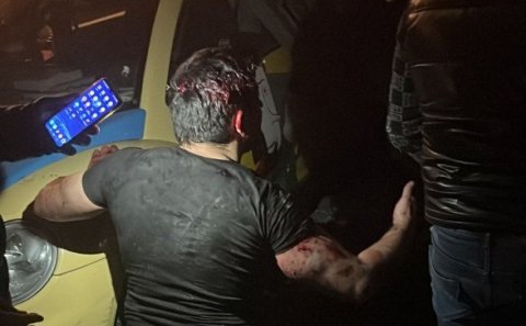 Bakının mərkəzində güclü partlayış - 31 yaralı, ölən var